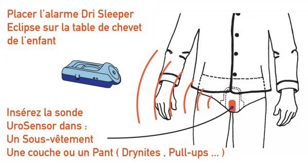 Stop-Pipi : explication du fonctionnement des alarmes énurésie 