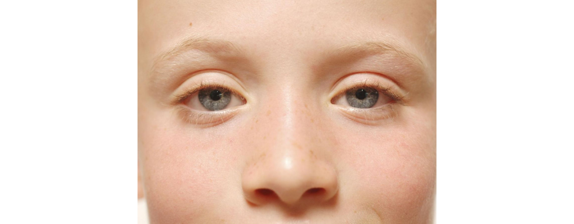 Autisme Asperger, savoir reconnaître les signes